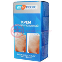 До и после крем а/целлюлит. 100мл. /твинс тэк/
