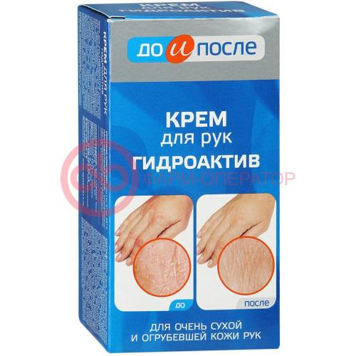 До и после крем для рук 100мл гидроактив