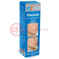 До и после лосьон для лица 200мл анти-акне д/пробл кожи